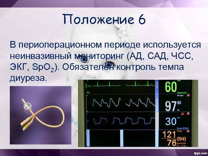 Положение 6 В периоперационном периоде используется неинвазивный мониторинг (АД, САД, ЧСС, ЭКГ, Sp. O