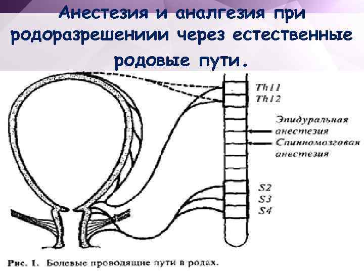 Анестезия в акушерстве и гинекологии презентация