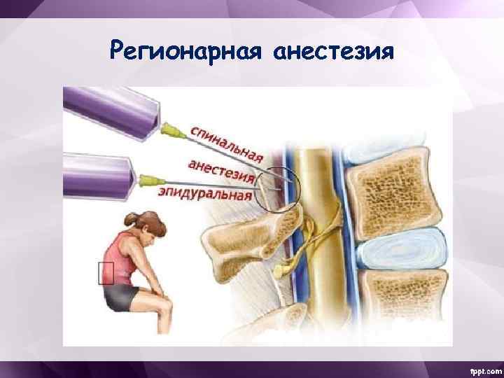 Регионарная анестезия 