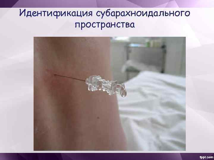 Идентификация субарахноидального пространства 