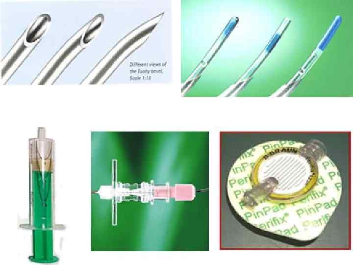 Техника выполнения эпидуральной анестезии 