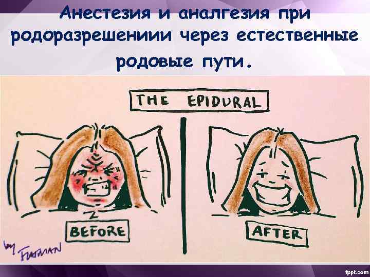 Анестезия и аналгезия при родоразрешениии через естественные родовые пути. 