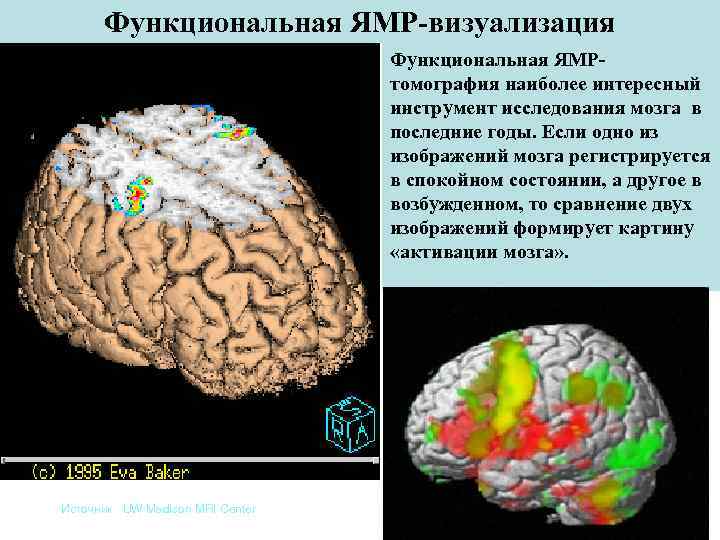 Функциональная ЯМР-визуализация Функциональная ЯМРтомография наиболее интересный инструмент исследования мозга в последние годы. Если одно