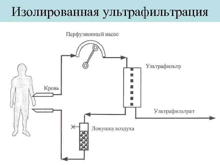 Изолированная ультрафильтрация 