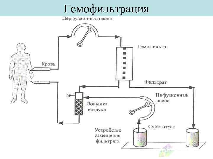 Принцип работы аппарата искусственная почка рисунок