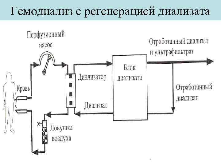 Принцип работы аппарата искусственная почка рисунок