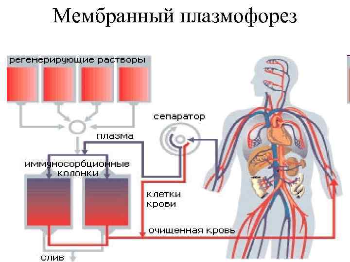 Мембранный плазмофорез 