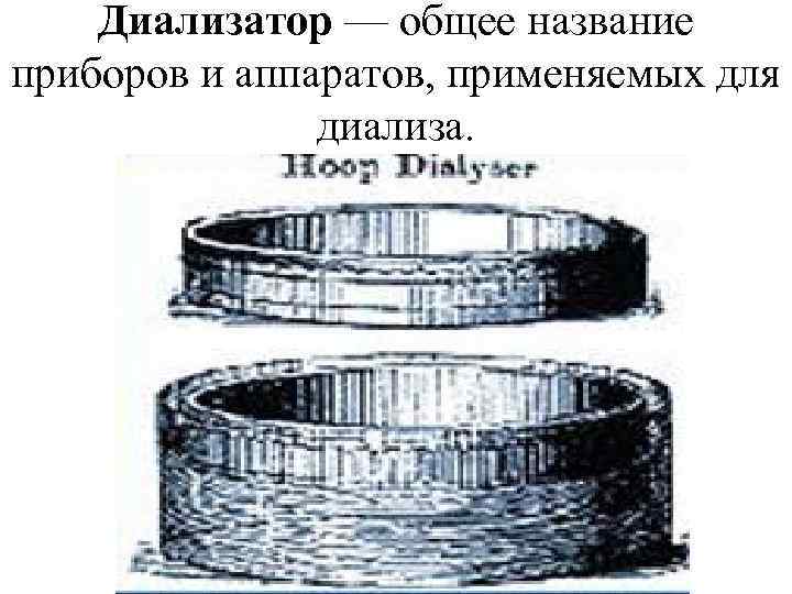 Диализатор — общее название приборов и аппаратов, применяемых для диализа. 