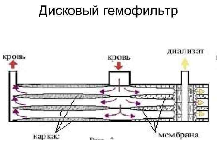 Дисковый гемофильтр 