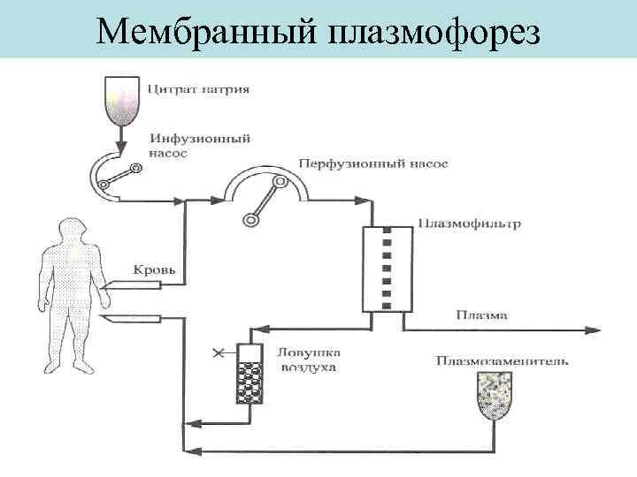 Плазмофорез что за процедура