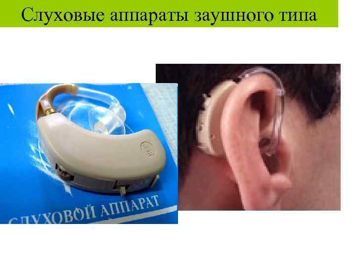 Слуховые аппараты заушного типа 