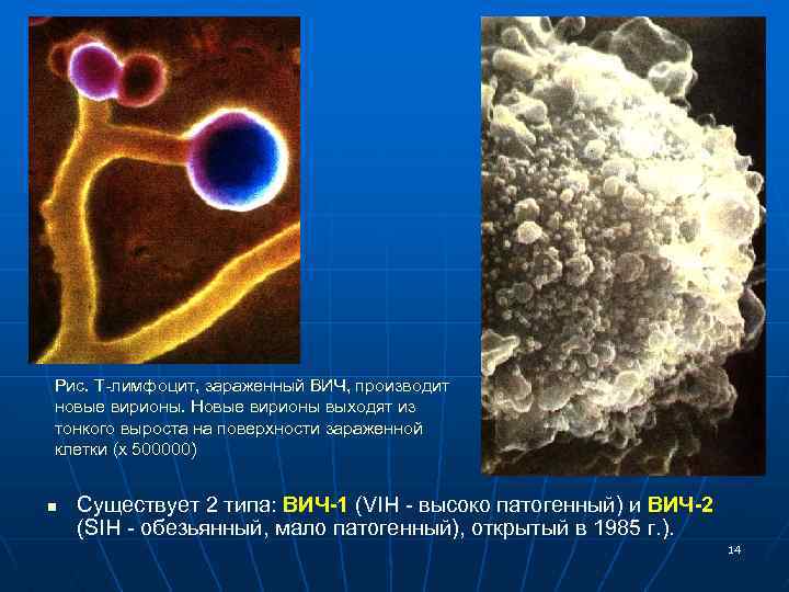 Рис. Т-лимфоцит, зараженный ВИЧ, производит новые вирионы. Новые вирионы выходят из тонкого выроста на