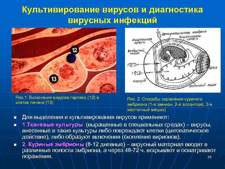 Культивирование вирусов и диагностика вирусных инфекций Рис. 1. Включения вирусов герпеса (12) в клетке