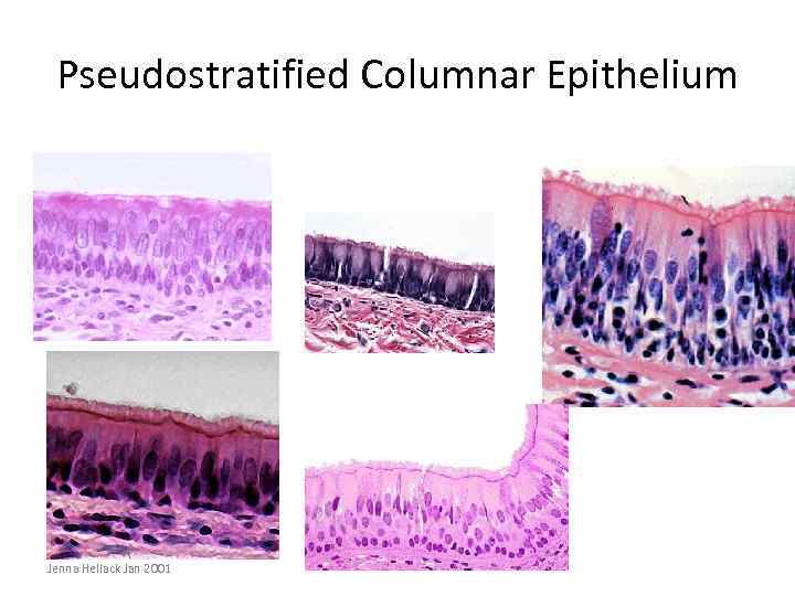 Pseudostratified Columnar Epithelium Jenna Hellack Jan 2001 