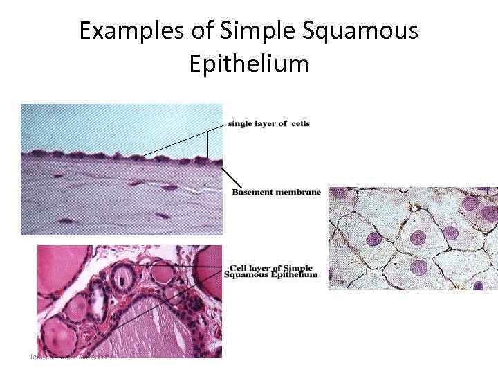 Examples of Simple Squamous Epithelium Jenna Hellack Jan 2001 