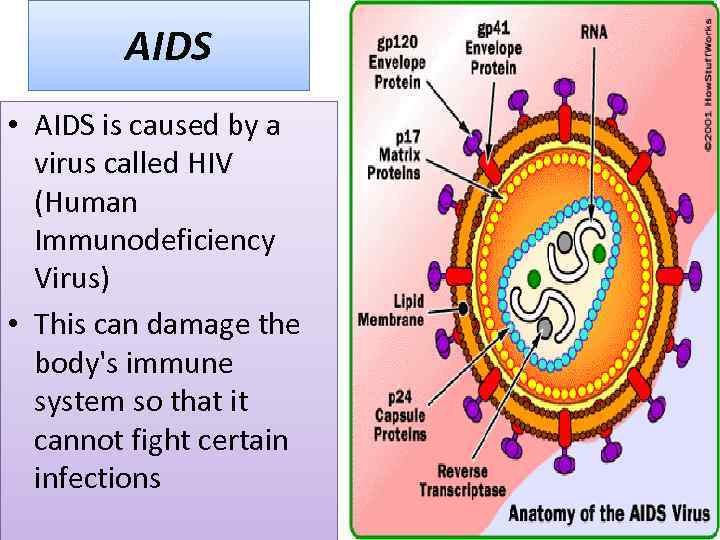 AIDS • AIDS is caused by a virus called HIV (Human Immunodeficiency Virus) •