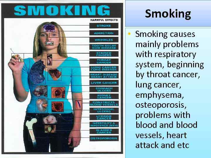 Smoking • Smoking causes mainly problems with respiratory system, beginning by throat cancer, lung