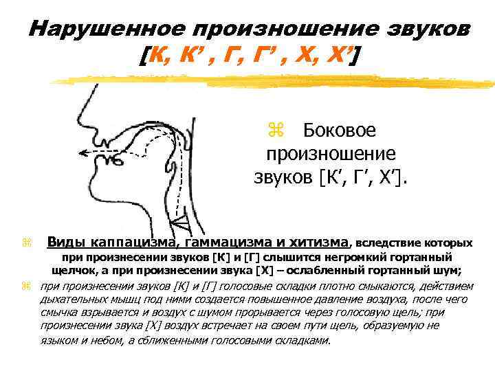 Нарушенное произношение звуков [К, К’ , Г, Г’ , Х, Х’] z Боковое произношение