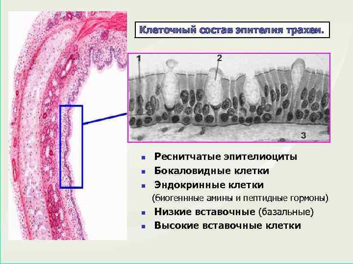 Реснитчатый эпителий органы. Мерцательный эпителий гистология. Многорядный мерцательный эпителий трахеи. Бокаловидные клетки трахеи гистология. Клетки дыхательная система гистология препарат.