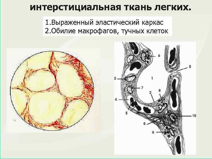 интерстициальная ткань легких. 1. Выраженный эластический каркас 2. Обилие макрофагов, тучных клеток 