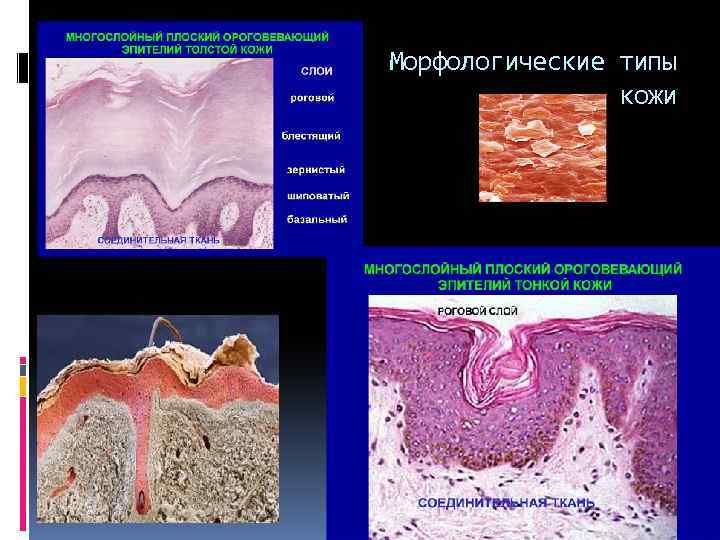Морфологические типы кожи 
