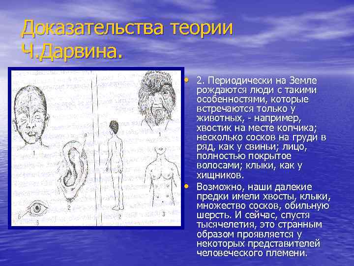 Доказательства теории Ч. Дарвина. • 2. Периодически на Земле • рождаются люди с такими