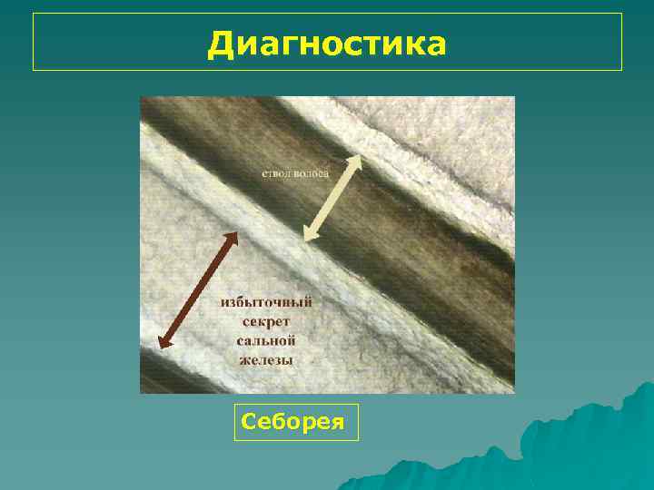 Диагностика Себорея 