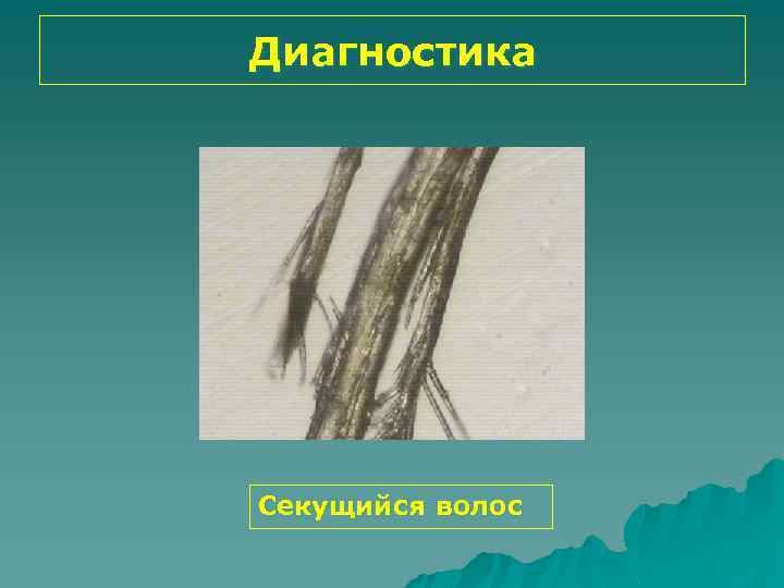 Диагностика Секущийся волос 