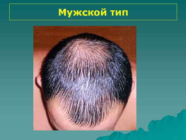 Мужской тип 