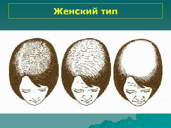 Женский тип 