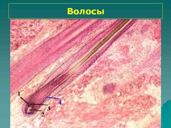 Кожа с волосом. Препарат сальная железа кожи гистология. Кожа волосистой части головы гистология препарат. Срез тонкой кожи гистология. Кожа с волосом гистология гематоксилин эозин.