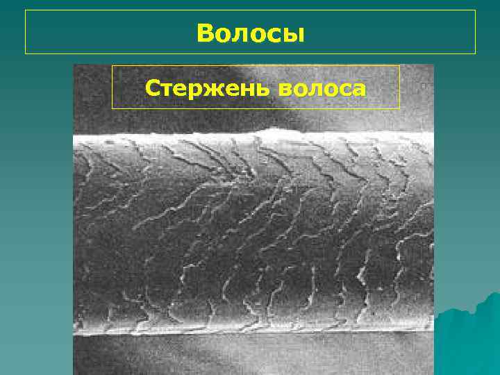 Волосы Стержень волоса 