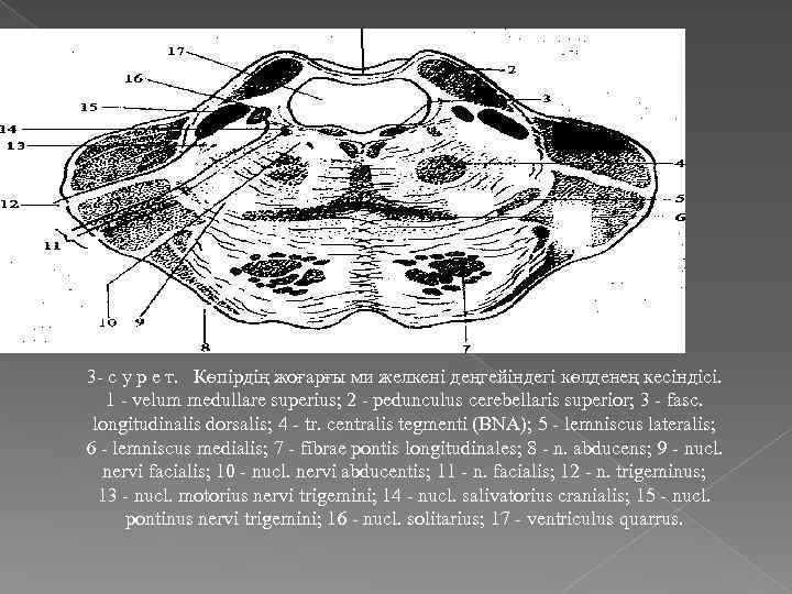 3 - с у р е т. Көпірдің жоғарғы ми желкені деңгейіндегі көлденең кесіндісі.