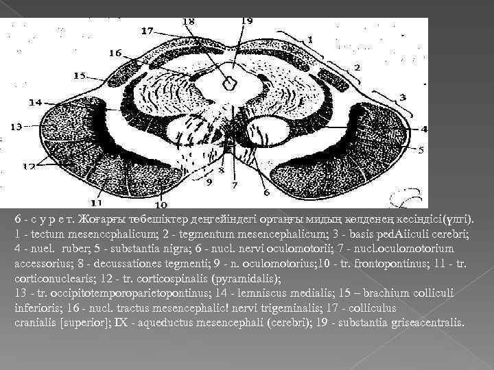 6 - с у р е т. Жоғарғы төбешіктер деңгейіндегі ортаңғы мидың көлденең кесіндісі(үлгі).