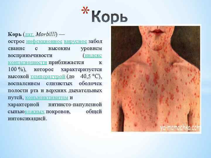 * Корь (лат. Morbilli) — острое инфекционное вирусное забол евание с высоким уровнем восприимчивости