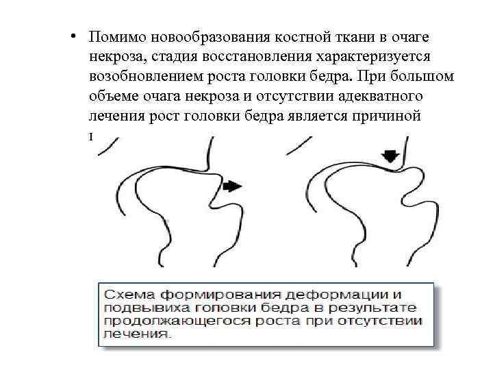  • Помимо новообразования костной ткани в очаге некроза, стадия восстановления характеризуется возобновлением роста