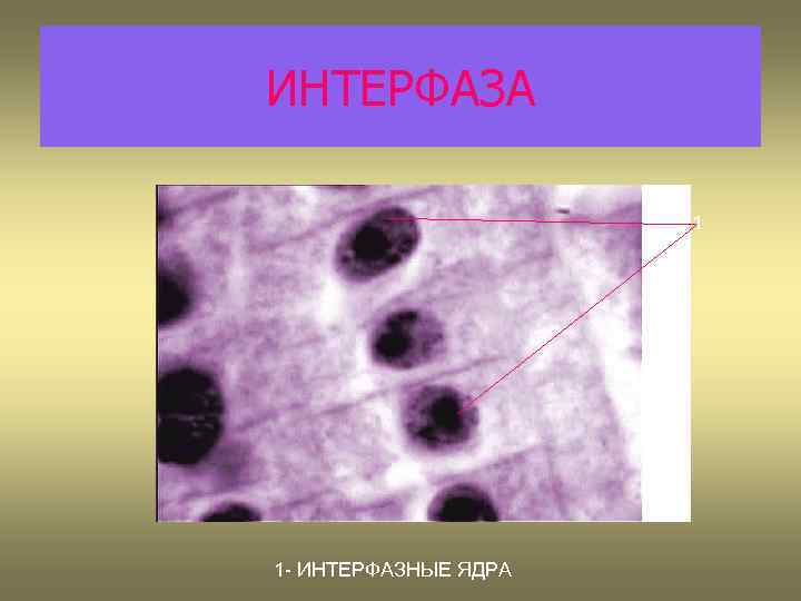 ИНТЕРФАЗА 1 1 - ИНТЕРФАЗНЫЕ ЯДРА 