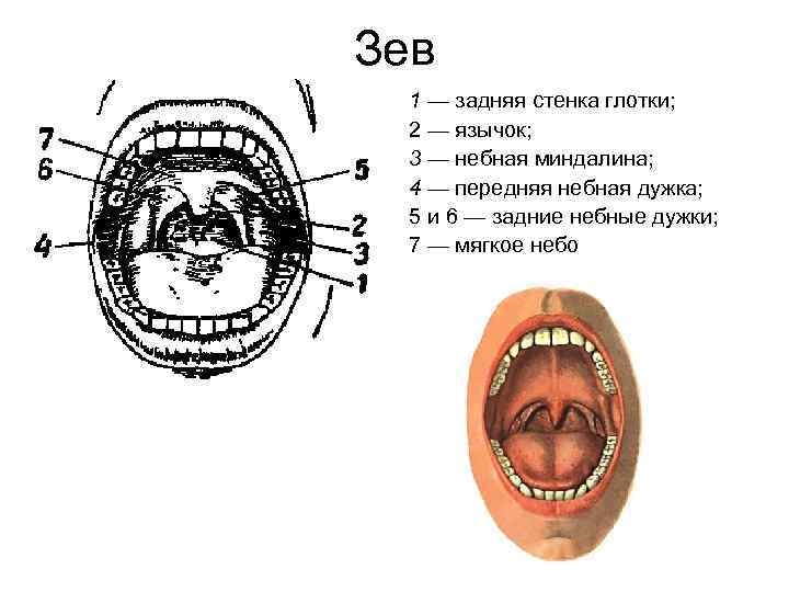 Зев 1 — задняя стенка глотки; 2 — язычок; 3 — небная миндалина; 4