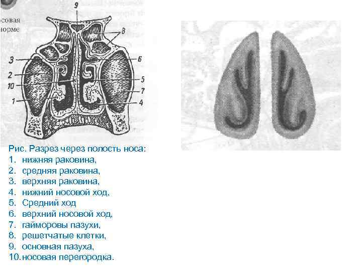 Рис. Разрез через полость носа: 1. нижняя раковина, 2. средняя раковина, 3. верхняя раковина,