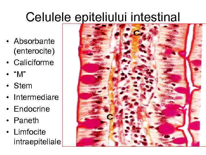 Celulele epiteliului intestinal • Absorbante (enterocite) • Caliciforme • “M” • Stem • Intermediare
