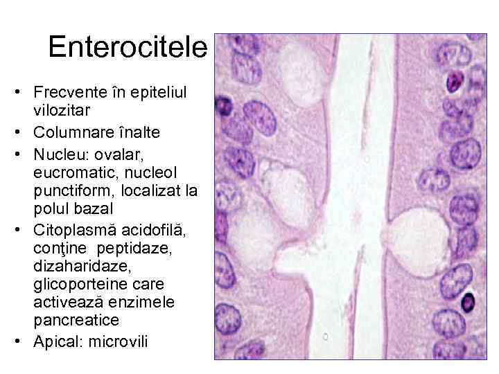 Enterocitele • Frecvente în epiteliul vilozitar • Columnare înalte • Nucleu: ovalar, eucromatic, nucleol