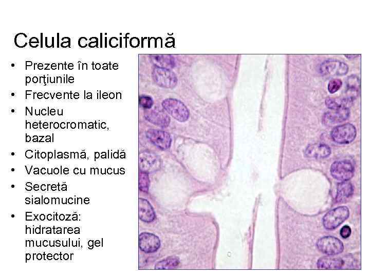 Celula caliciformă • Prezente în toate porţiunile • Frecvente la ileon • Nucleu heterocromatic,