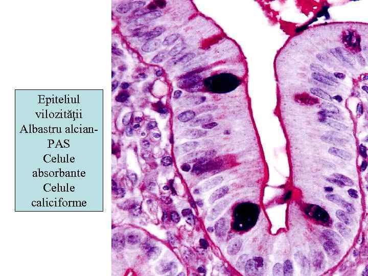 Epiteliul vilozităţii Albastru alcian. PAS Celule absorbante Celule caliciforme 