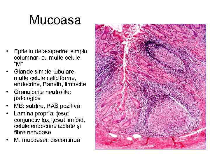 Mucoasa • Epiteliu de acoperire: simplu columnar, cu multe celule “M” • Glande simple
