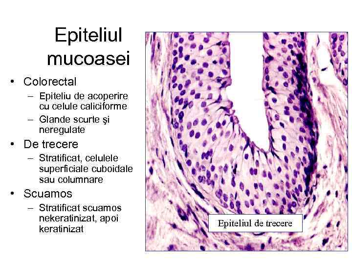 Epiteliul mucoasei • Colorectal – Epiteliu de acoperire cu celule caliciforme – Glande scurte