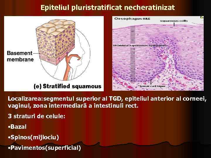Epiteliul pluristratificat necheratinizat Localizarea: segmentul superior al TGD, epiteliul anterior al corneei, vaginul, zona