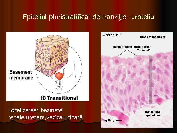 Epiteliul pluristratificat de tranziţie -uroteliu Localizarea: bazinete renale, uretere, vezica urinară 