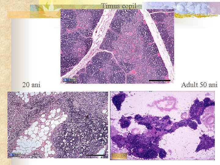 Timus copil 20 ani Adult 50 ani 