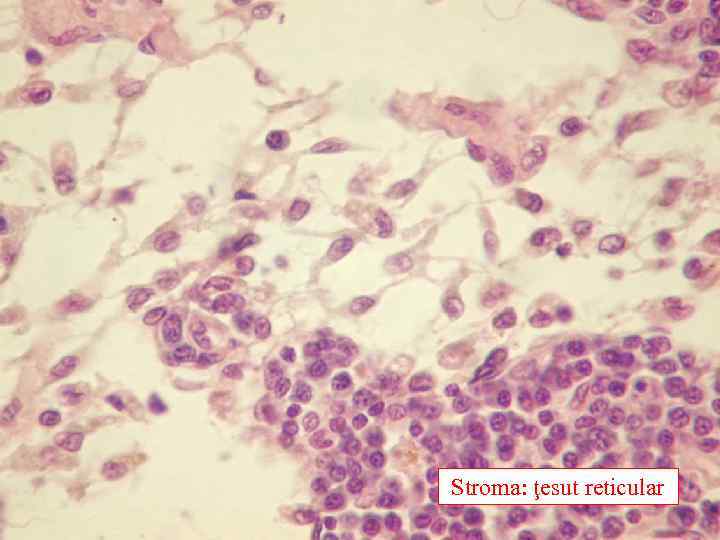 Stroma: ţesut reticular 