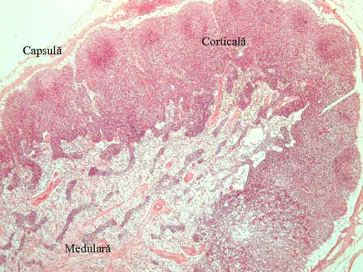 Corticală Capsulă Medulară 